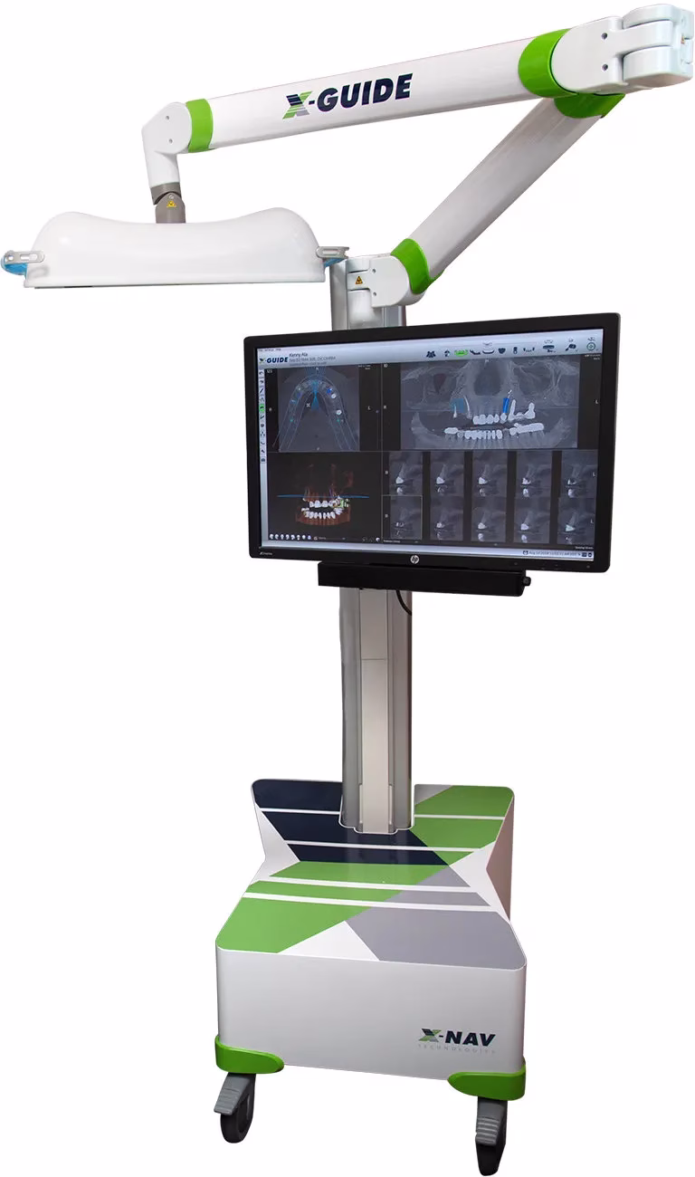 X-Guide guided surgery system for dental implant placement with a display showing 3D images and diagnostic information.